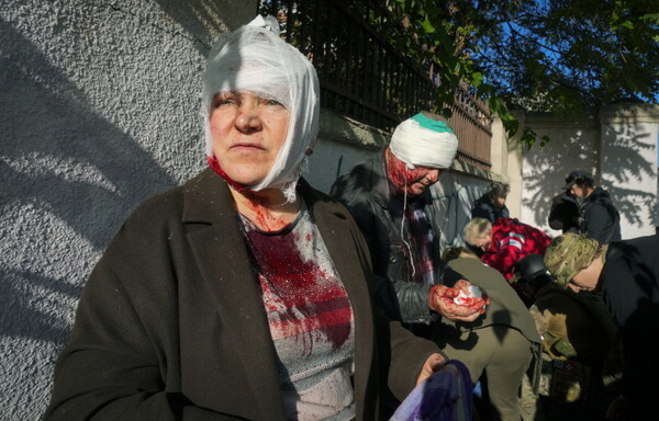 러시아의 미사일 공격으로 부상한 우크라이나 수도 키이우 주민들이 치료를 받고 있다.