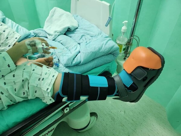 장모씨의 20대 딸은 이태원 사고로 오른쪽 다리를 다쳐 깁스를 했다. 부친 제공.