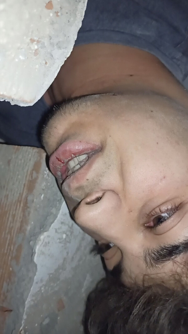 튀르키예 17세 소년 타하 에르뎀이 2월6일 지진 발생으로 무너진 아디야만 시내 아파트 건물잔해 밑에 깔린채 촬영한 휴대전화기 동영상의 일부.