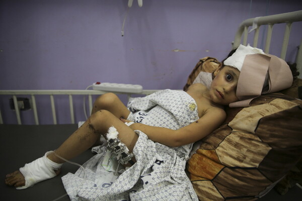 이스라엘군의 폭격으로 부상한 팔레스타인의 4살 소년이 1일 가자지구 디르 알 발라의 알 아크사 병원 침상에 누워 있다. 가자지구 북부 주요 병원의 발전기가 2일 새벽(현지시간)부터 가동이 중단됐다고 가자지구 보건부가 밝혔다. 병원은 소형 예비 발전기 운영 등 비상조치를 통해 며칠 간 업무를 계속할 수 있지만 전기와 연료를 확보하지 못하면 대재앙에 직면하게 될 것이라고 하마스 보건부는 밝혔다. 2023.11.02.
